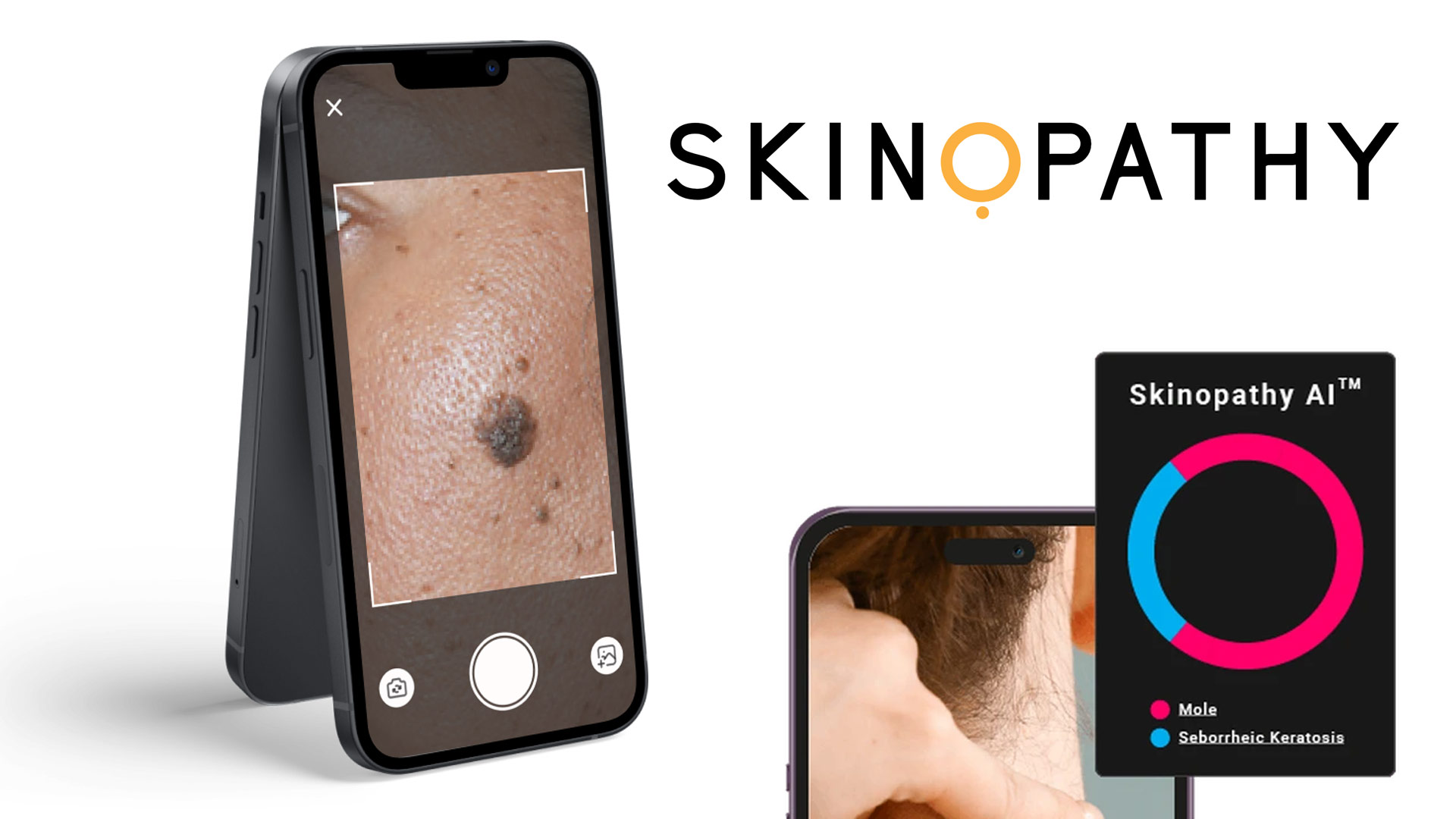 Skinopathy HealthTech App focused on Skin Cancer